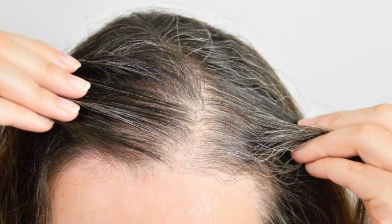 Voici 5 aliments pour lutter contre leur apparence.