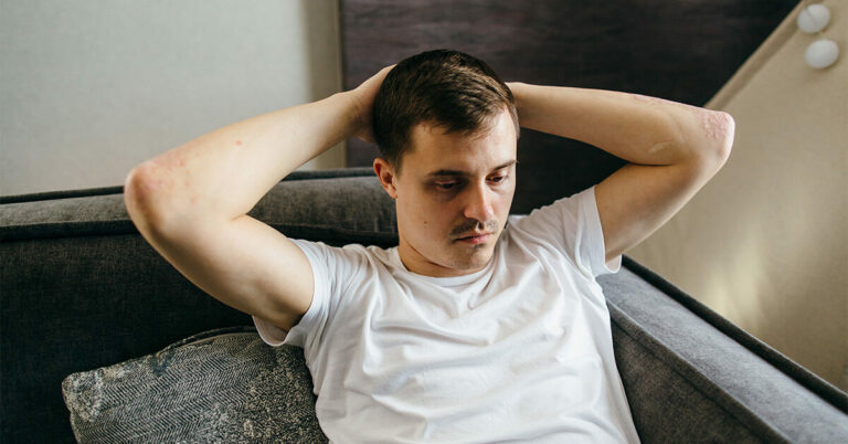 Ce que nous savons du COVID à long terme et de la durée des symptômes