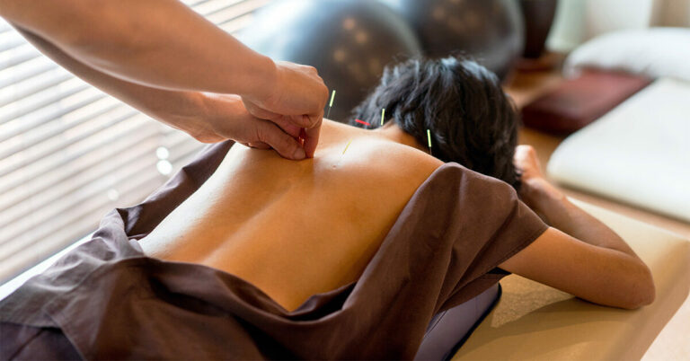 L’acupuncture peut aider à prévenir le diabète de type 2, selon une étude